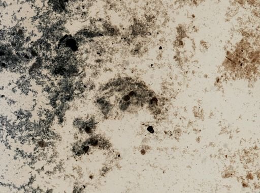 Entamoeba histolytica