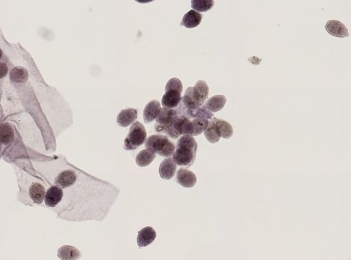 Echinococcus