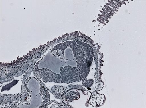 Oroperipatus corradoi