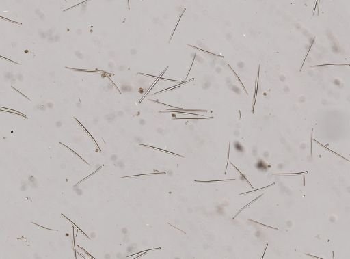 Cliona celata