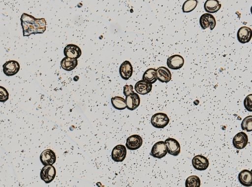 Diphyllobothrium latum