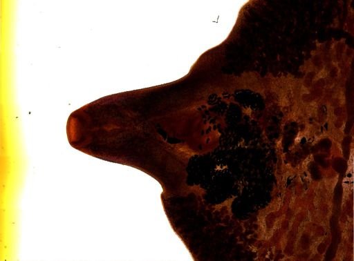 Fasciola hepatica