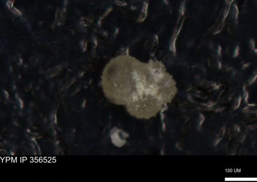 undet. Foraminiferida