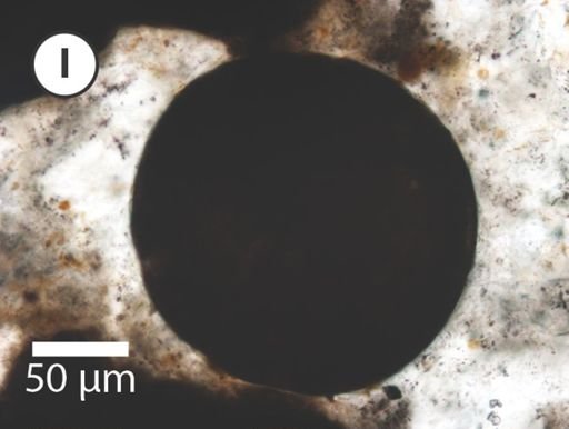 Megasphaera miniscula