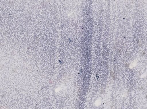 Trypanosoma lewisi