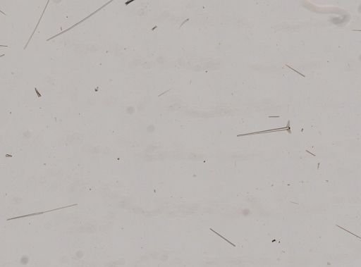 Ecionemia walkeri