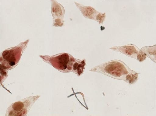 Epiphanes senta