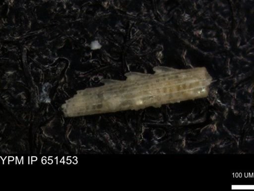 undet. Echinoidea