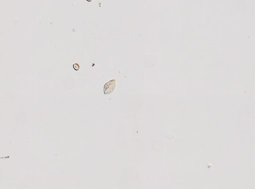 Cestoda