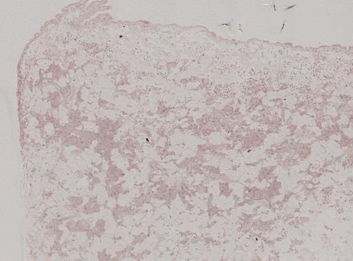 Modiolus