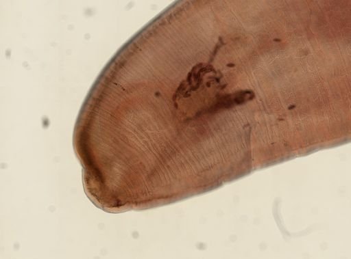 Oligacanthorhynchus microcephalus