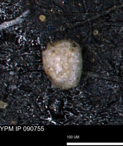 Glomospira tortuosa