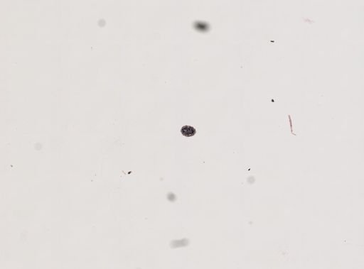 Protohydra leuckarti