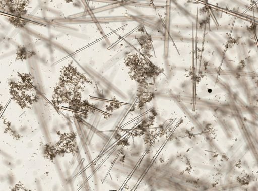 Tectitethya crypta?