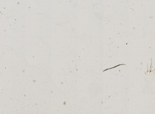 Plasmodium falciparum