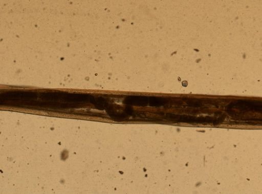 Enterobius vermicularis