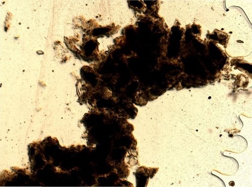 Celleporella?