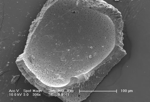 Globorotalia inflata