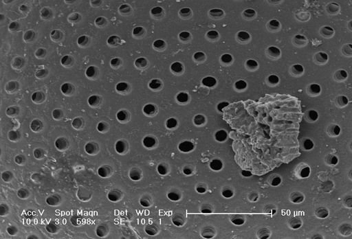 Globigerinoides sacculifer