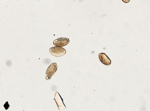 Fasciolopsis buski