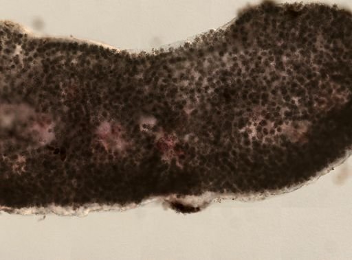Chondrilla nucula