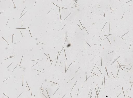 Myxilla incrustans