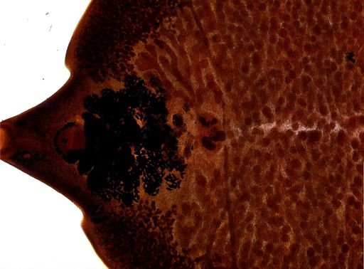 Fasciola hepatica
