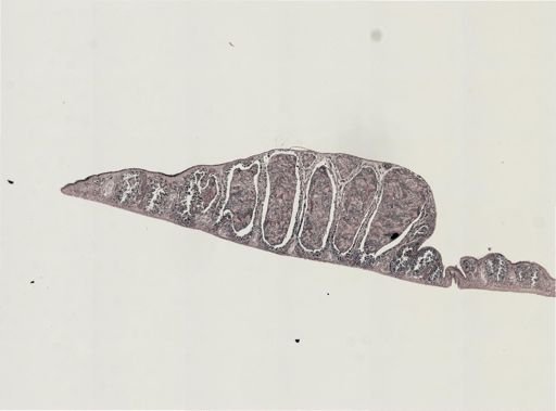 Foviella