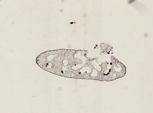 Dicrocoelium dendriticum