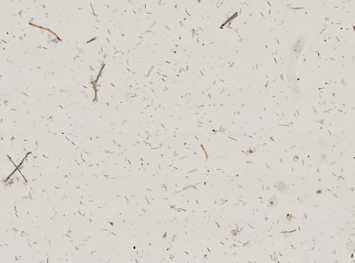 Callyspongia (Toxochalina)