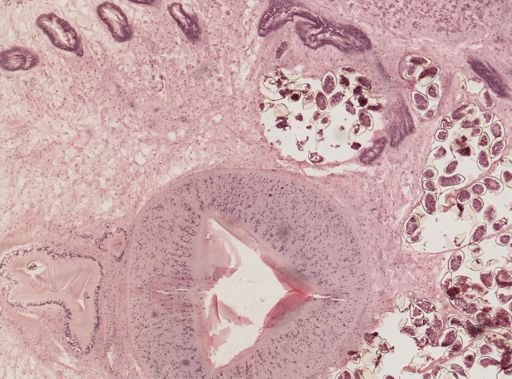 Fasciola hepatica