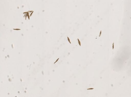 Paramecium