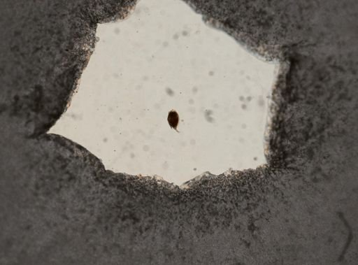 Euchlanis dilatata