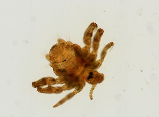 Pthirus pubis