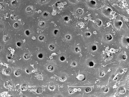 Globigerinoides ruber