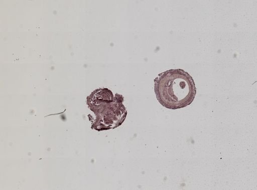 Nemertea