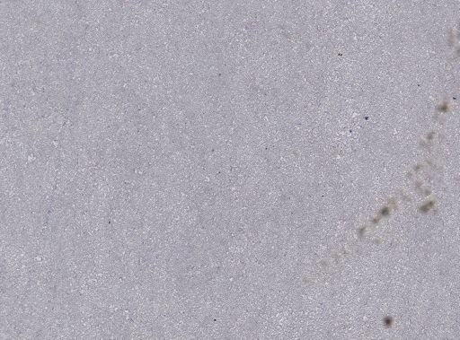 Leucocytozoon