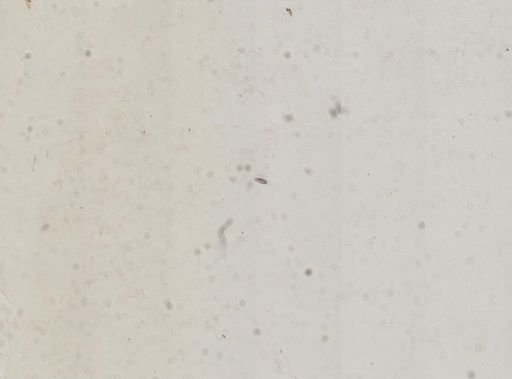 Paramecium