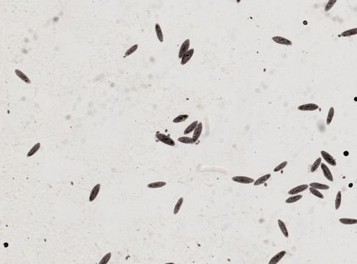 Paramecium caudatum