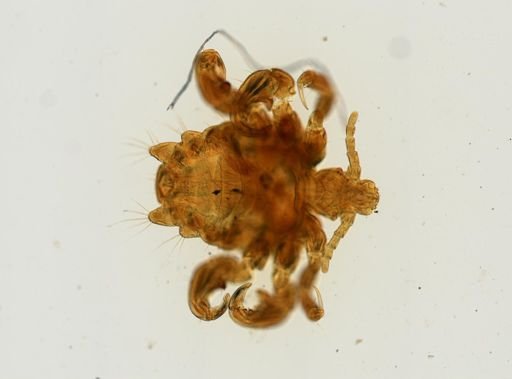 Pthirus pubis