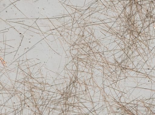 Craniella cranium