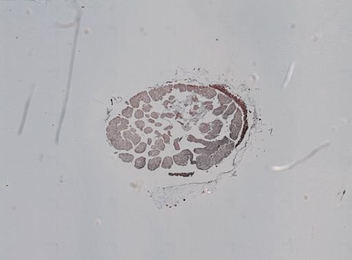 Vampyroteuthis infernalis