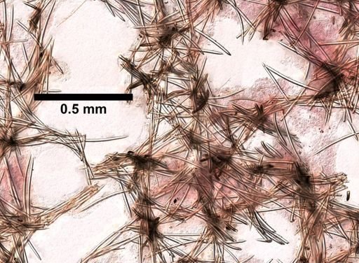 Xestospongia muta