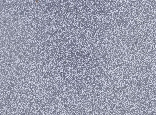 Plasmodium vivax