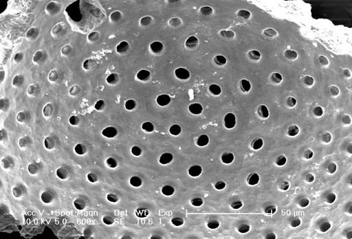 Globigerinoides sacculifer