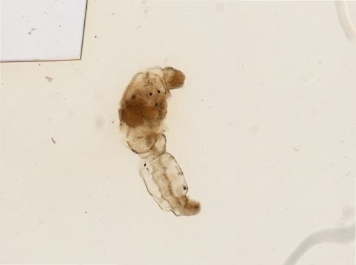 Chaetogaster limnaei