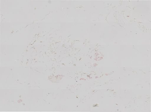 Distomum