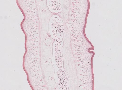 Taenia saginata