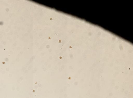 Dicrocoelium dendriticum