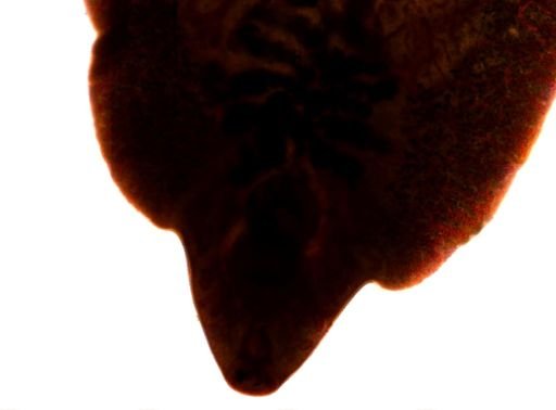 Fasciola hepatica